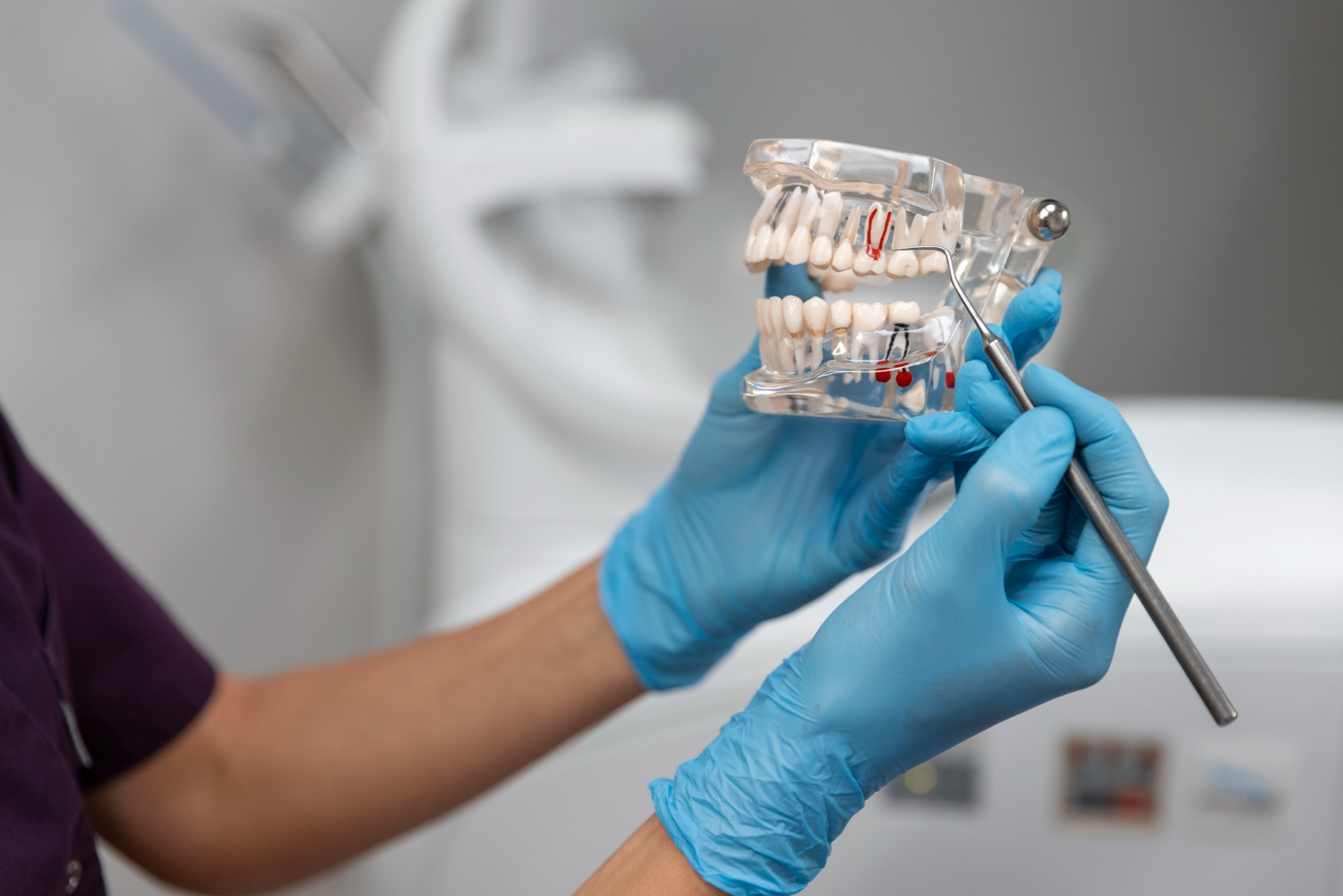 Quanto costa un impianto dentale in albania