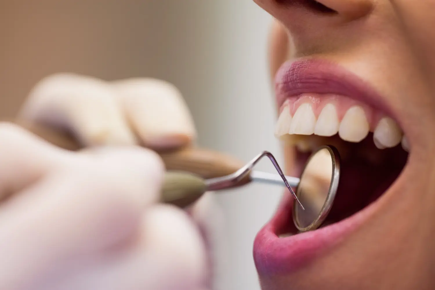 Root Canal Treatment Side Effects: What to Expect from the Procedure